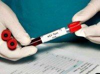 AP Photo/Sherry Yates Young