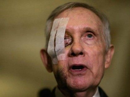 harry-reid-injured-eye-AFP-420x315.jpg