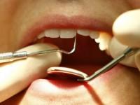 Teeth