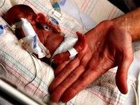 AP Photo/Loyola University Medical Center, A. Hayashi