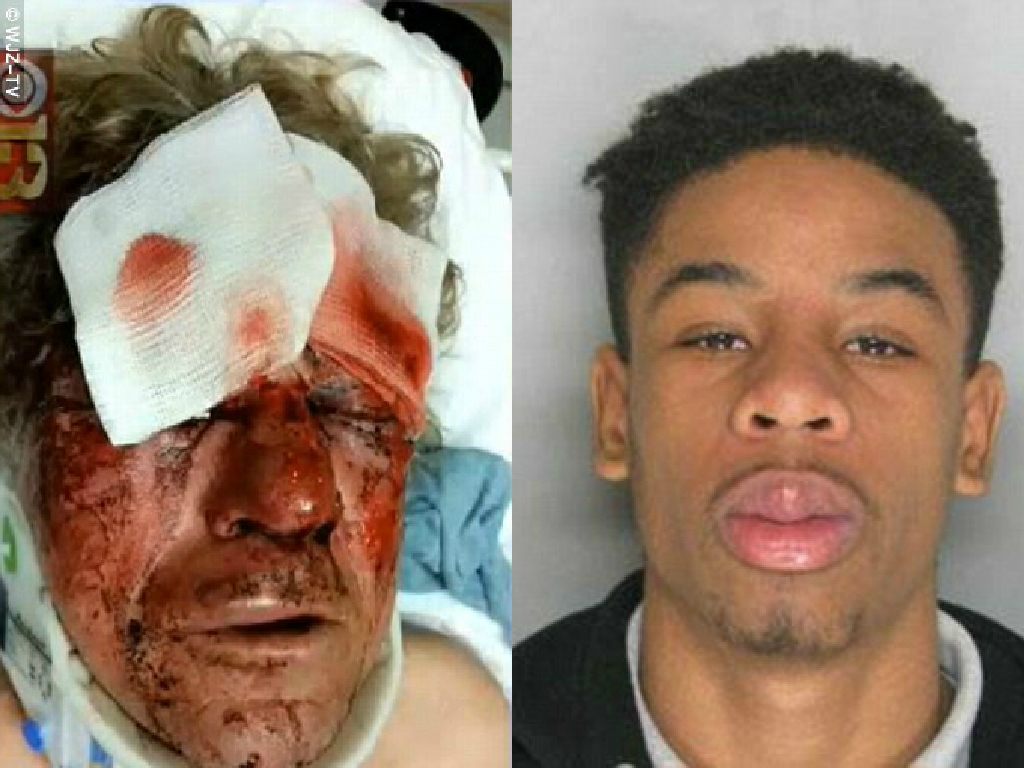 Beaten Up By Black Teens 5