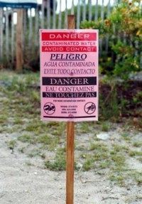 Fecal contamination at the beach -- watch where you step
