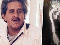 world's longest penis