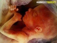 amnesty international