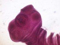 Tapeworm (Wikimedia Commons)