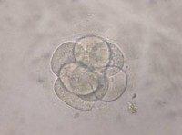 California judge: Divorced couple's embryos must be destroyed