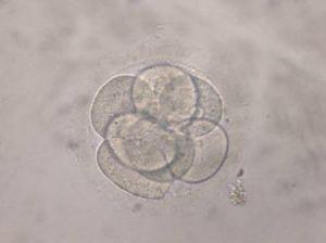 California judge: Divorced couple's embryos must be destroyed