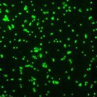 Francisella tularensis bacteria