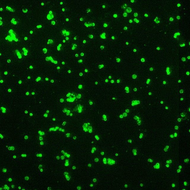 Francisella tularensis bacteria