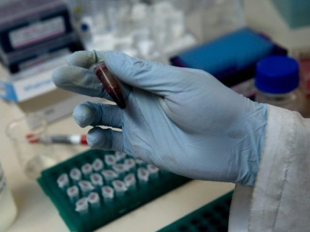 Israeli Scientists Develop New Drug That May Be Cure For Aids