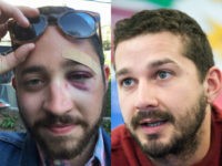 NYC Man Knocked Unconscious for Looking ‘Like Shia LaBeouf’