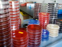 superbugs