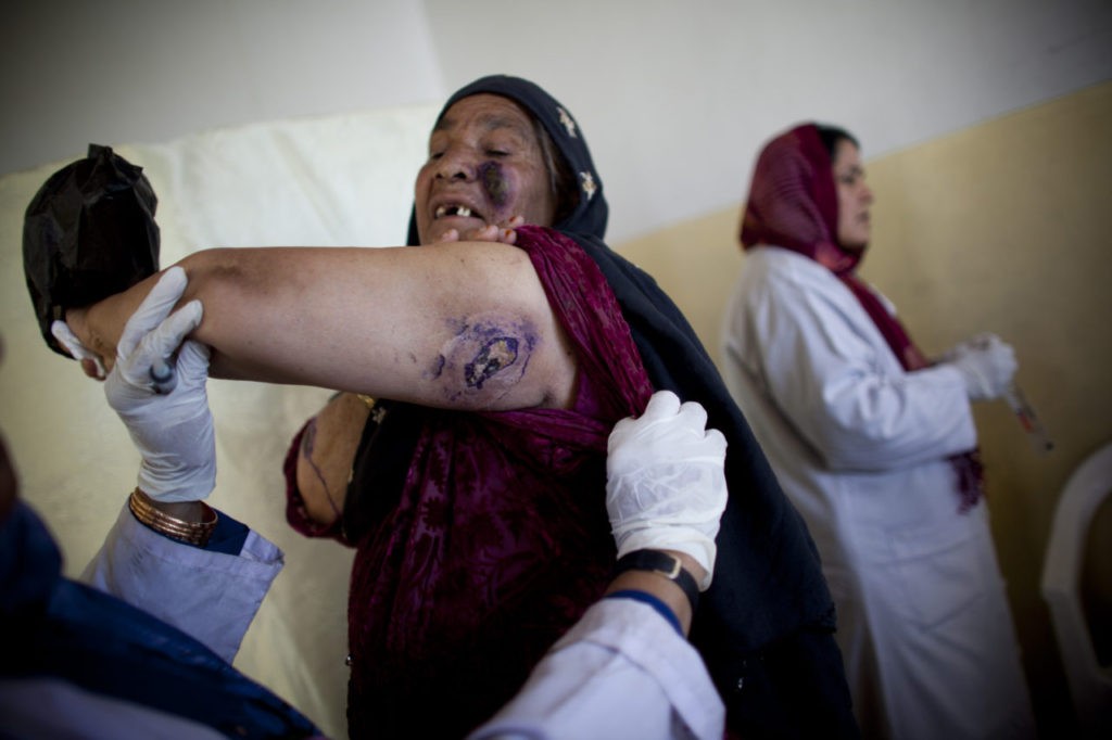 KABUL, AFGHANISTAN - MAY 15: Afghans receive treatment for a tropical skin disease at a clinic on May 15, 2010 south of Kabul, Afghanistan. The Afghan capital, Kabul, has one of the highest concentrations of the disfiguring skin disease, Cutaneous leishmaniasis, which is a parasitic disease transmitted by the phlebotomine sand fly. The World Health Organization estimated the number of cases in Kabul jumped from 17,000 in early 2000 to around 65,000 in 2009; the disease is non-lifethreatening and treatable with medication. (Photo by Majid Saeedi/Getty Images)