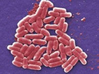 This 2006 colorized scanning electron micrograph image made available by the Centers for Disease Control and Prevention shows the O157:H7 strain of the E. coli bacteria. On Wednesday, May 26, 2016, U.S. military officials reported the first U.S. human case of bacteria resistant to an antibiotic used as a last resort drug. The 49-year-old woman has recovered from an infection of E. coli resistant to colistin. But officials fear that if the resistance spreads to other bacteria, the country may soon see germs impervious to all antibiotics. (Janice Carr/CDC via AP)