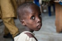 This photo taken on June 30, 2016 shows a boy suffering from severe acute malnutrition sitting at one of the Unicef nutrition clinics in the outskirts of Maiduguri capital of Borno State, northeastern Nigeria