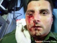 Border Patrol Agent eye injury - file photo