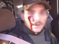 Border Patrol agent assaulted