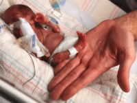 Abortion