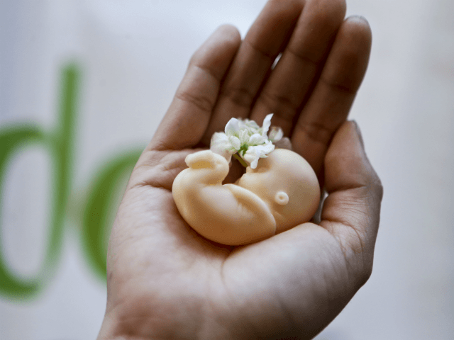 A woman holds a fetus doll in the palm of her hand outside the Constitutional Court building where anti-abortion and pro-abortion groups gathered to wait for the court's decision on whether to uphold a measure that would end the country's absolute ban on abortions, in Santiago, Monday, Aug. 21, 2017. The court went on to accept the constitutionality of a measure to legalize abortions when a woman's life is in danger, when a fetus is not viable and in cases of rape. Congress recently approved the bill and President Michelle Bachelet has said she will sign it into law. (AP Photo/Esteban Felix)
