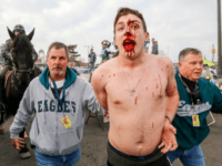 WATCH: Police Called in to Break Up Bloody Fight at Eagles’ Lincoln Financial Field