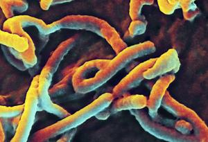 Healthcare worker in Glasgow has Ebola