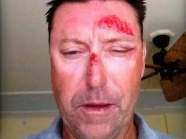 Robert Allenby