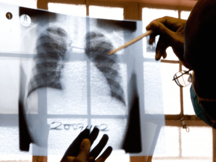Tuberculosis (Karin Schermbrucker / Associated Press)