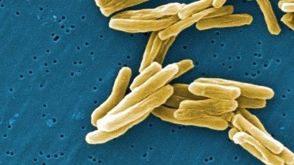 Tuberculosis CDC