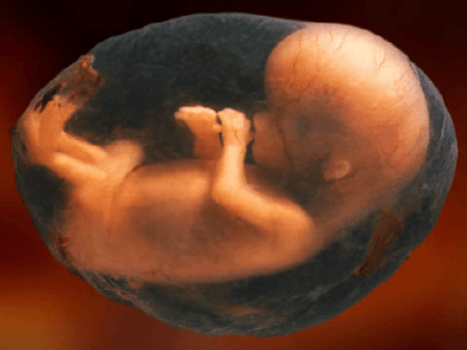 fetus-in-sac