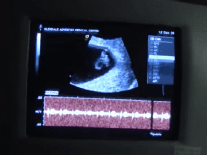 6-week-6-day-old-fetus-640x427