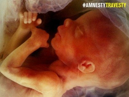 amnesty international