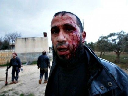 Syria-Homs-rebel-injured AP