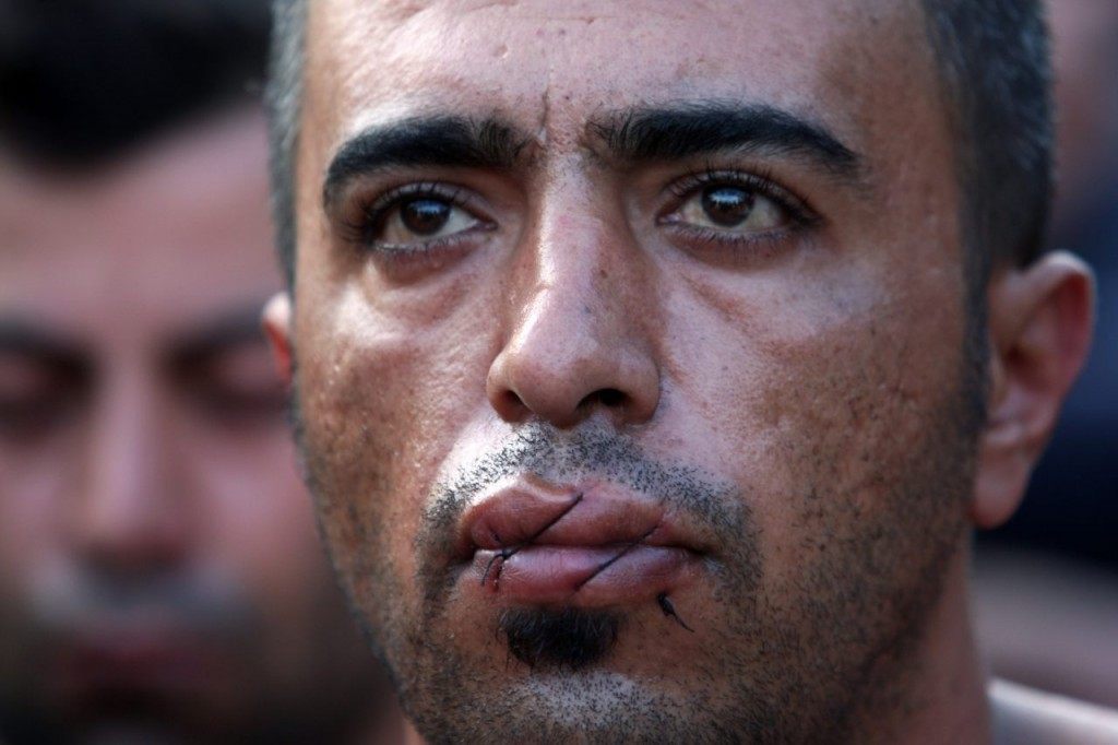 A man claiming to be from Iran, with his mouth sewn shut, takes part in a demonstration with fellow migrants and refugees as they wait to cross the Greek-Macedonian border near Idomeni on November 24, 2015. At least five migrants stuck on the Greek-Macedonian border on Monday sewed their lips in protest at not being allowed to continue their journey to Europe. Syrian, Iraqi and Afghan refugees are allowed through but those deemed economic migrants – mainly people from Iran, Pakistan and Bangladesh – are blocked. AFP PHOTO /Sakis Mitrolidis / AFP / SAKIS MITROLIDIS (Photo credit should read SAKIS MITROLIDIS/AFP/Getty Images)