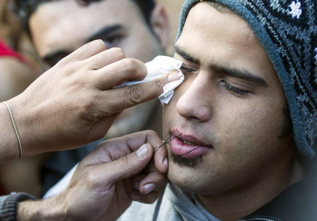 A man uses needle and thread to sew shut the mouth of a compatriot from Iran, as another wipes his eyes, as a sign of protest as migrants and refugees wait to cross the Greek-Macedonian border near Gevgelija on November 26, 2015. Since last week, Macedonia has restricted passage to northern Europe to only Syrians, Iraqis and Afghans who are considered war refugees. All other nationalities are deemed economic migrants and told to turn back. Over 1,500 people are stuck on the border, mostly Indian, Moroccan, Bangladeshi and Pakistani. AFP PHOTO / ROBERT ATANASOVSKI / AFP / ROBERT ATANASOVSKI (Photo credit should read ROBERT ATANASOVSKI/AFP/Getty Images)