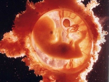 Fetus in Womb