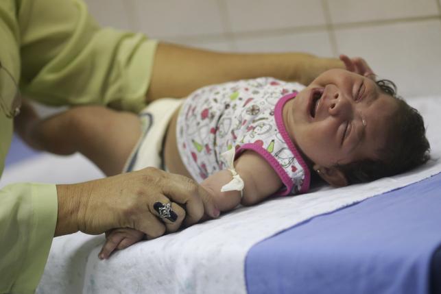 Hospital staff Oswaldo Cruz prepares to draw blood from baby Lorrany Emily da Silva, who has microcephaly, at the Oswaldo Cruz Hospital in Recife, Brazil