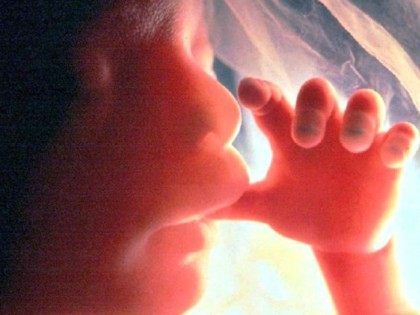 fetus in womb AP