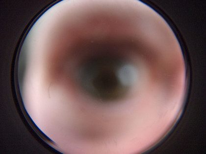 Eyehole (Paul Downey / Flickr / CC / Cropped)