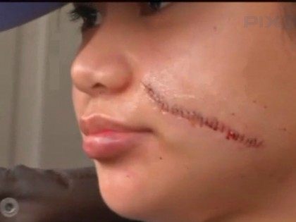 paula-delos-santos-face-slashing-victim-in-nyc-pix11-screenshot