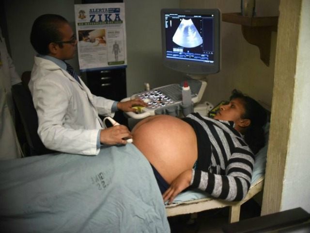 A pregnant woman gets an ultrasound at the maternity of the Guatemalan Social Security Institute (IGSS) in Guatemala City on February 2, 2016. Zika virus