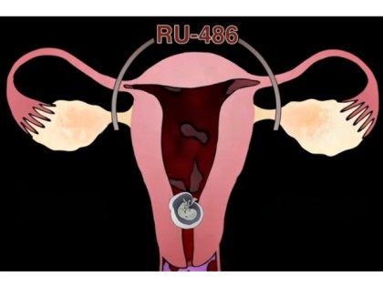 Abortion animated video