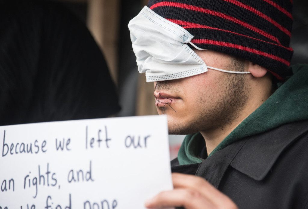 An Iranian migrant who sew his lips to protest against the dismantling of the southern half of the so-called "Jungle" migrant camp, stages a protest with other Iranian migrants in the French northern port city of Calais, on March 3, 2016. Demolition workers razed makeshift shelters at the so-called Jungle migrant camp on the outskirts of Calais for a fourth day running on March 3, under the close watch of dozens of police officers equipped with water cannon. / AFP / DENIS CHARLET (Photo credit should read DENIS CHARLET/AFP/Getty Images)