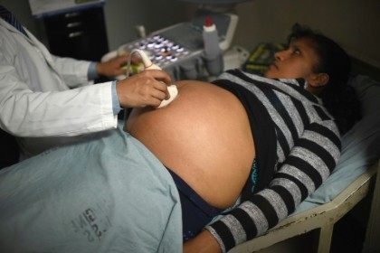A pregnant woman gets an ultrasound at the maternity of the Guatemalan Social Security Ins