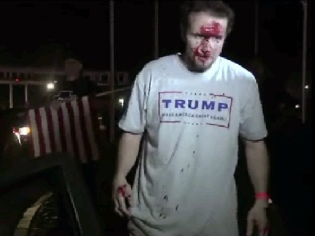 This still image taken from video shows a supporter of Republican presidential candidate Donald Trump after a protest on Thursday, April 28, 2016 in Costa Mesa, Calif. Dozens of protesters were mostly peaceful Thursday as Trump gave his speech inside the Pacific Amphitheater. After the event, however, the demonstration grew …