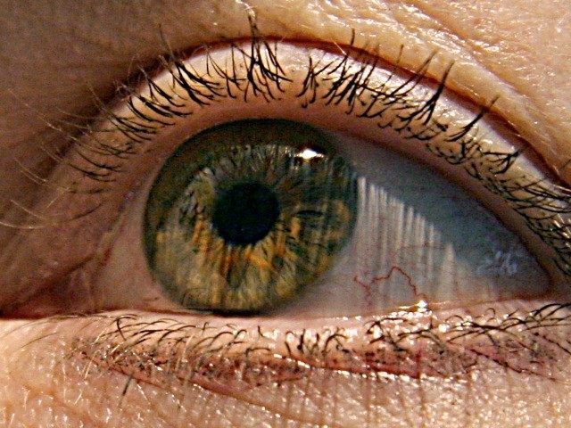 US scientists have identified two genes responsible for macular degeneration, the gradual