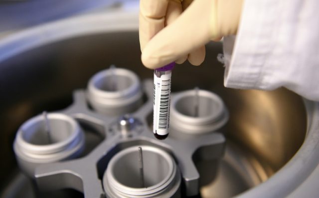 A technician holds blood samples before testing them at the French national anti-doping la