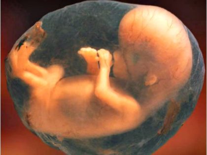 8 week fetus in womb