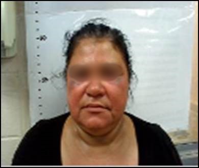 Honduran illegal immigrant who was brutally beaten by human smugglers while trying to keep them from raping her 11-year-old daughter.