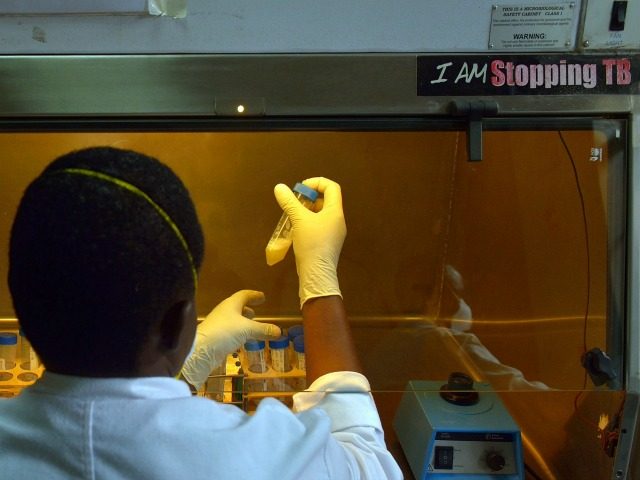 A laboratory technician tests sputum samples for tuberculosis strains. File.