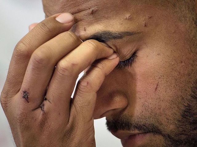 Angel Colon, a surviver of the Pulse nightclub mass shooting, listens during a press conference with Orlando Health trauma staff at Orlando Regional Medical Center June 14, 2016 in Orlando, Florida. Two days after 49 people were killed and dozens of others grievously injured in America's deadliest mass shooting, Colon, …